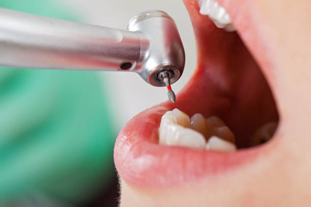 Best Tooth Infection Emergency Dentist  in Dobson, NC